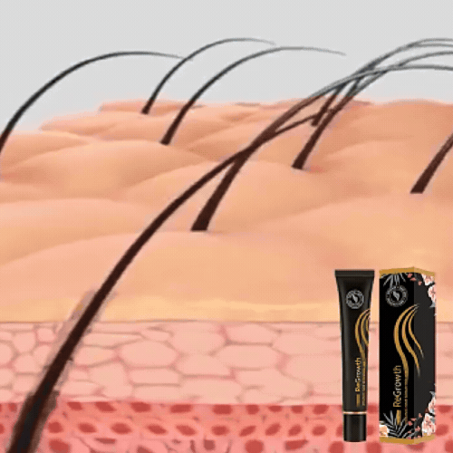 ForceRacine - LineDouceur